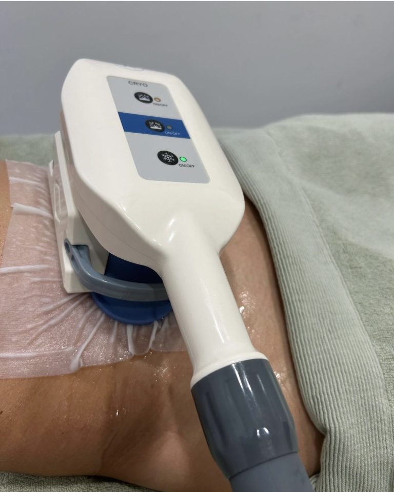 Application d’un masque de cryolipolyse sur la zone abdominale pour traitement minceur non invasif