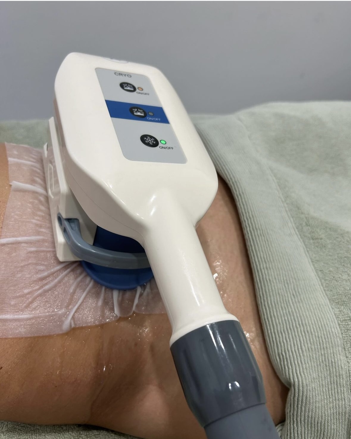 Application d’un masque de cryolipolyse sur la zone abdominale pour traitement minceur non invasif