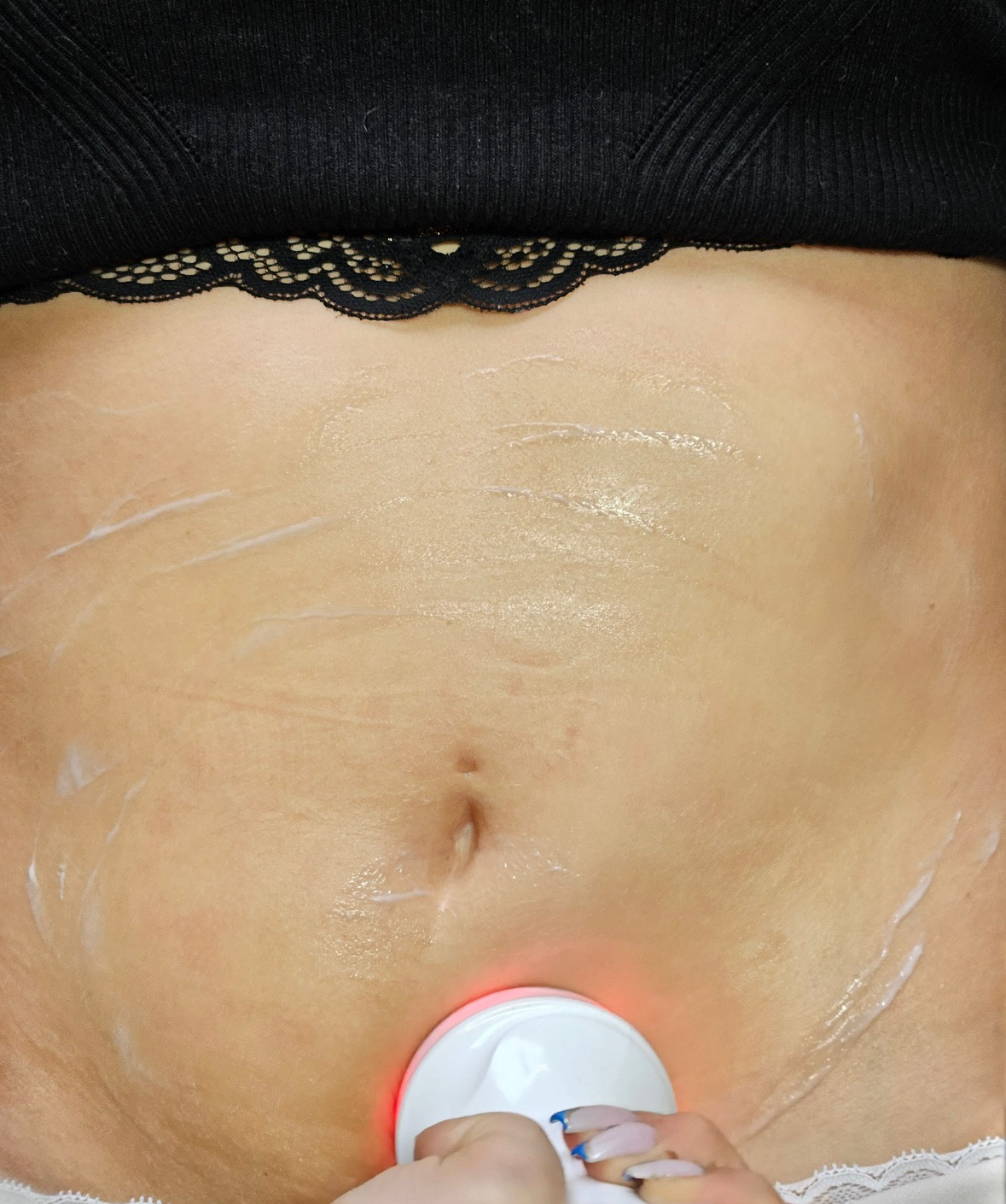 Soin raffermissant Refit corps sur la zone abdominale avec appareil à radiofréquence esthétique